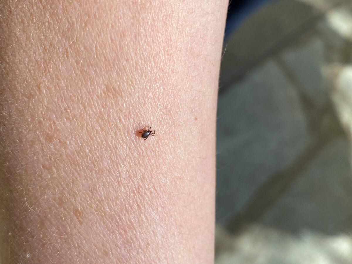 Solange die Zecke noch nicht gestochen hat, lässt sich diese einfach entfernen. Ein gründliches Absuchen nach dem Aufenthalt in der Natur ist daher besonders wichtig. Archivfoto: privat
